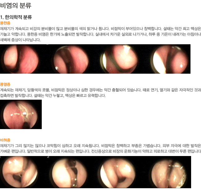 ���� �з�-�������� �з�-ǳ����,ǳ����,������.