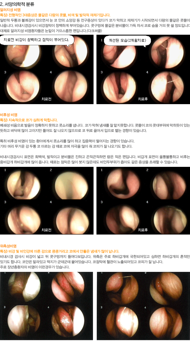 ���������� �з�-�˷����� ��,���ļ���,���༺��