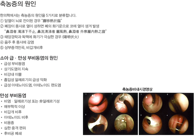 ������� ����-�Ҿ� ��/���� �κ񵿿� ����,���� �κ񵿿�.