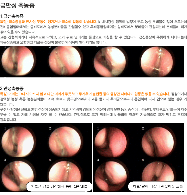 �޸��� �����-�޼������(��������� �ݻ缺 ������ ����ų� ���ҿ� ������ �ֽ��ϴ�.),���������(�Ӹ��� �״��� ������ �ʰ� �ٸ� �Ӹ��� �ѵ��ϰ� ���ſ�� ������ ���� ���� ��Ÿ���� ������ ���� �� �ֽ��ϴ�.)