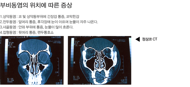 �κ񵿿� ��ġ�� ���� ����-��ǵ���,���ε���,��񵿿�,��������