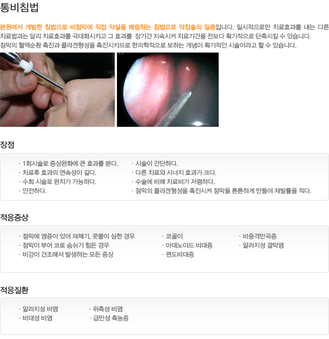 ���ħ��-�������� ������ ħ������ �������� ���� ����� �Ÿ��ϴ� ħ������ ��ħ���� �����Դϴ�. ����. ��������. ������ȯ