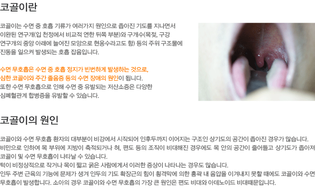 �ڰ��̶�?-���� ��ȣ���� ���� �� ȣ�� ������ ����ϰ� �߻��ϴ� ������ ���� �ڰ��̿� �ְ� ������ �� ��������� ������ �˴ϴ�. �ڰ����� ����.