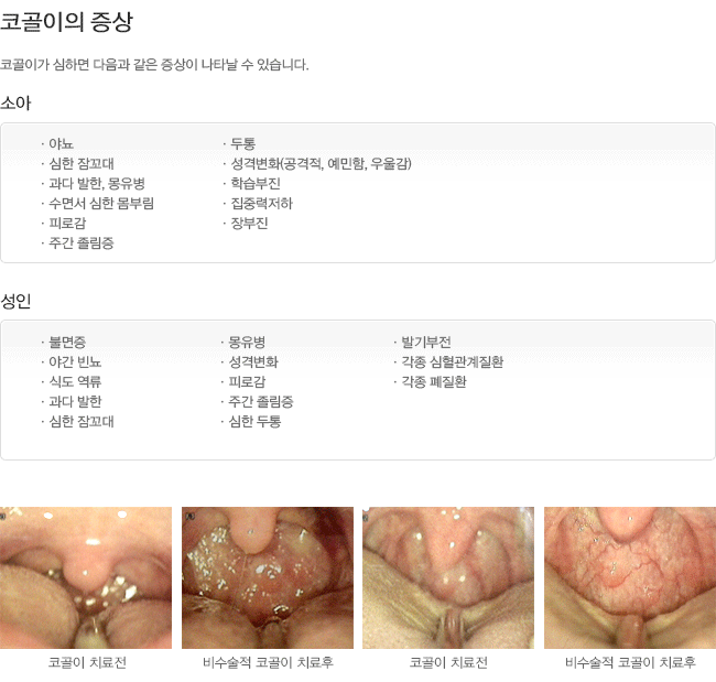 �ڰ����� ����-�Ҿ�,����.