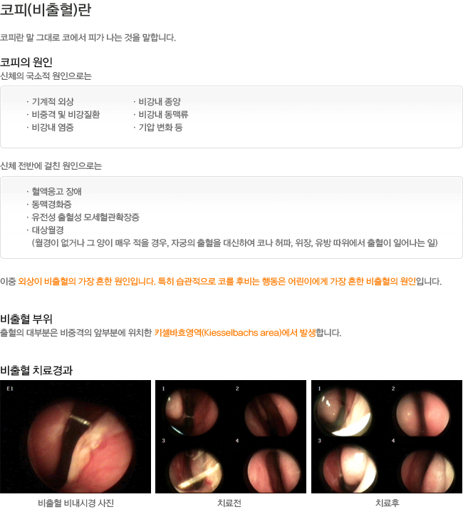 ����(������)��? ������ ����-�ܻ��� ���� ū �����Դϴ�. ������ ����-��κ��� ���߰� �պκп� ��ġ�� ī�����念������ �߻��մϴ�. ������ ġ����