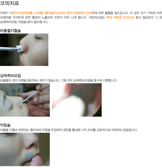 ����ġ��-������������,��ü�����,��ħ��.