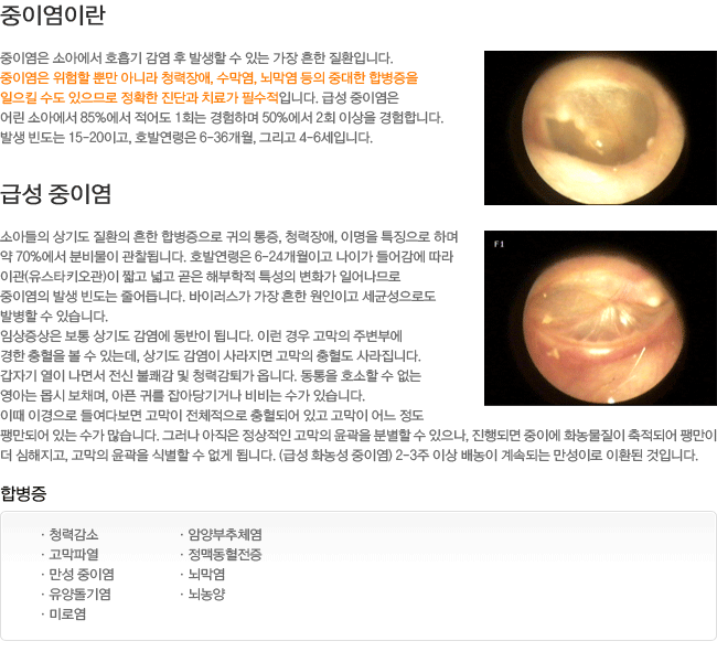 ���̿��̶�? �޼� ���̿�. �պ���