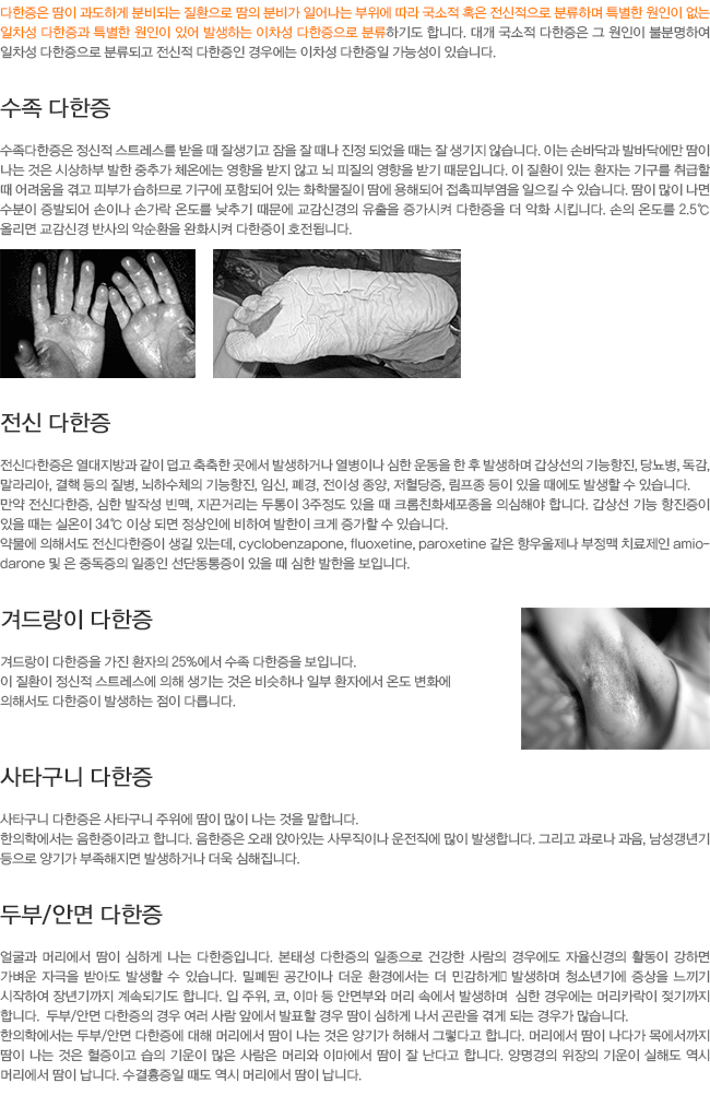 ����������. ���Ŵ�����. �ܵ���� ������. ��Ÿ���� ������. �κ�/�ȸ� ������